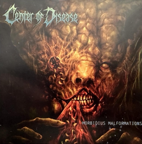 Center Of Disease - Morbidius Malformations (CD)