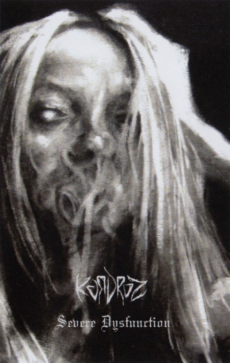 Kardroz ‎ - Severe Dysfunction (MC)